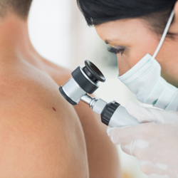 Melanoma