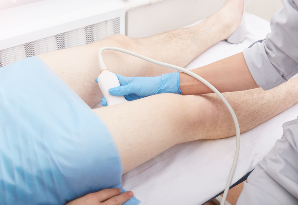Vessels Ultrasound 1149890324