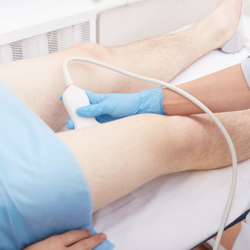 Vessels Ultrasound 1149890324