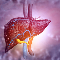 Liver Cancer