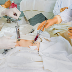 Bone Marrow Transplant